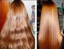 Quando è Consigliato?